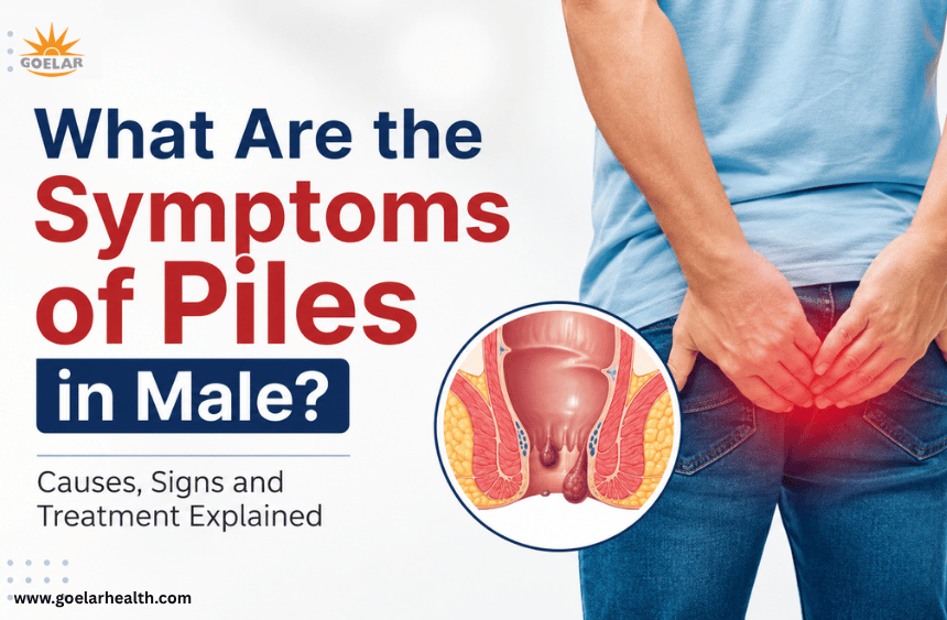 What Are the Symptoms-of-Piles-in-Male